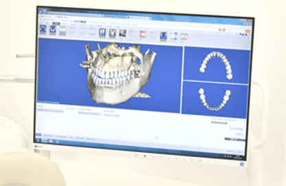 矯正治療のメリット 矯正治療のメリット