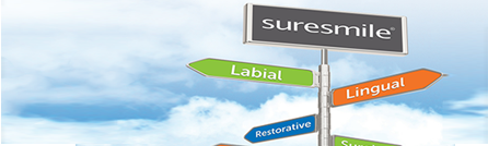 デジタル矯正システムについて